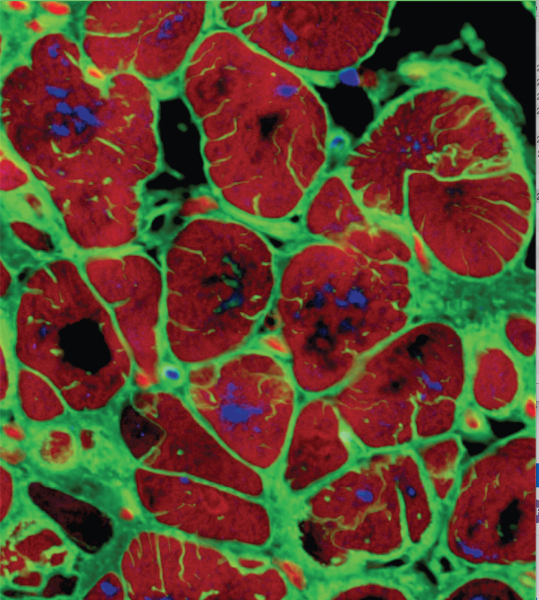 Photo of muscle cells and T-tubules going into the muscle, like thin lines