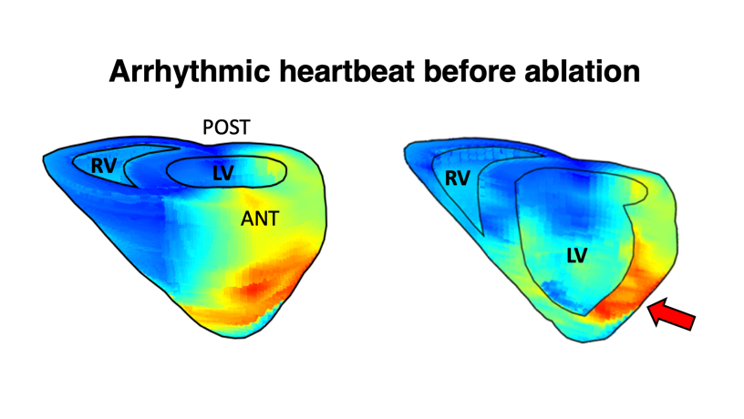 Electromechanical wave imaging