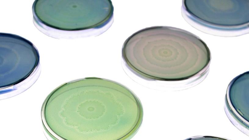 Petri dishes of engineered and native Proteus mirabilis patterns stained with colored dyes