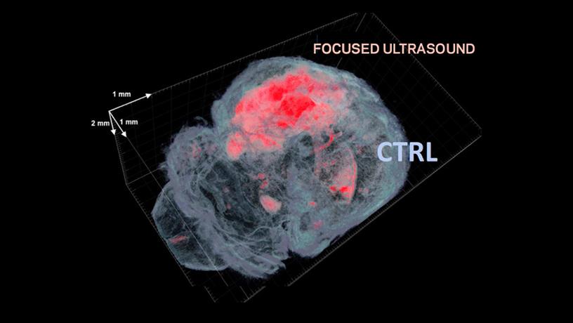 Mouse brain 3D fluorescence imaging with CLARITY showcasing the BBB opened volume for gene delivery.