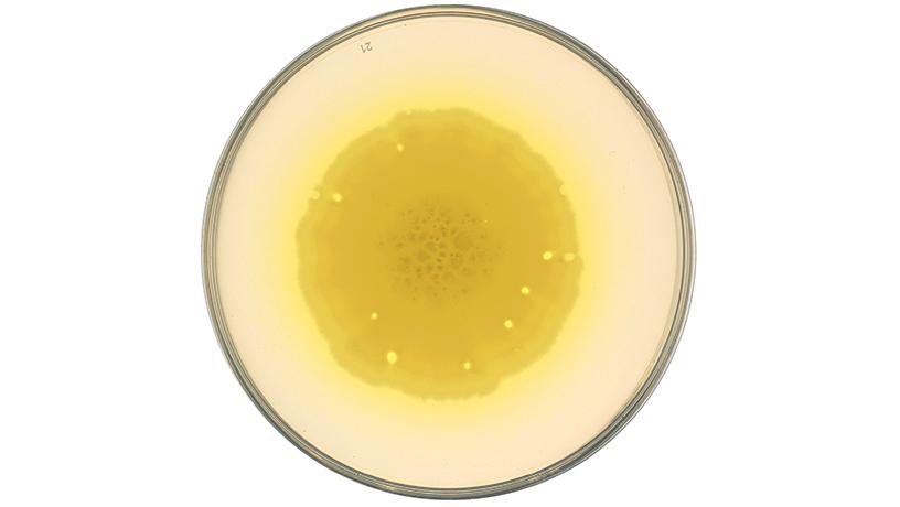 Finding Beauty in the World of Microbes | Biomedical Engineering