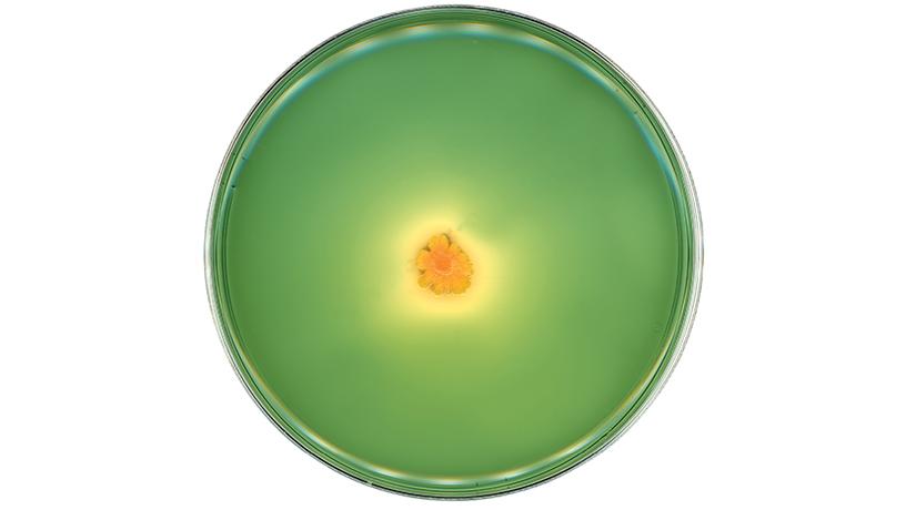 Finding Beauty in the World of Microbes | Biomedical Engineering