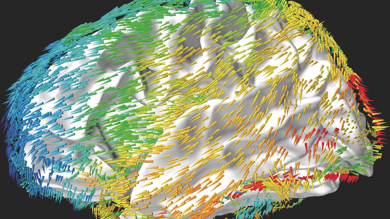 Scientific brain visualization showing a 3D cortical surface overlaid with multicolored directional fiber pathways and neural connectivity vectors.