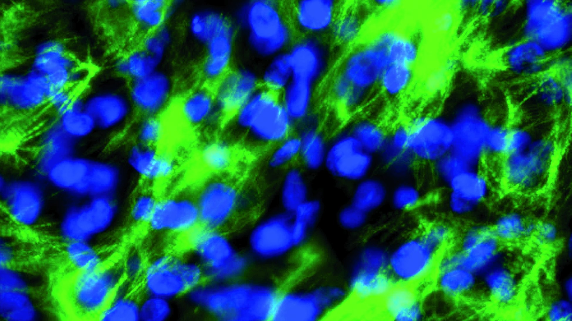 Fluorescent microscopy image showing bright green cellular fibers and blue nuclei against a dark background.