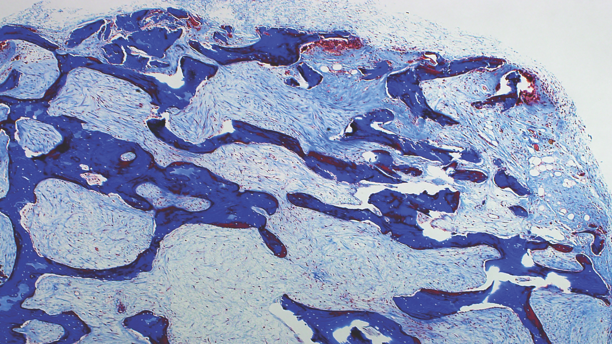 Histology micrograph of engineered bone in a trichome, showing irregular dark-blue trabecular bone-like matrix with pale blue tissue spaces and scattered red-stained regions near the surface.