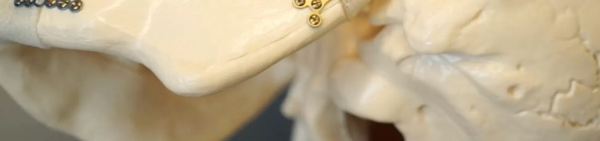 skull