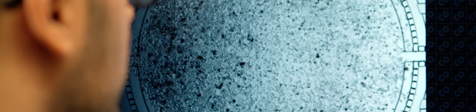 Close-up of a researcher in glasses looking at a screen displaying a circular microscopic image filled with many small speck-like particles.