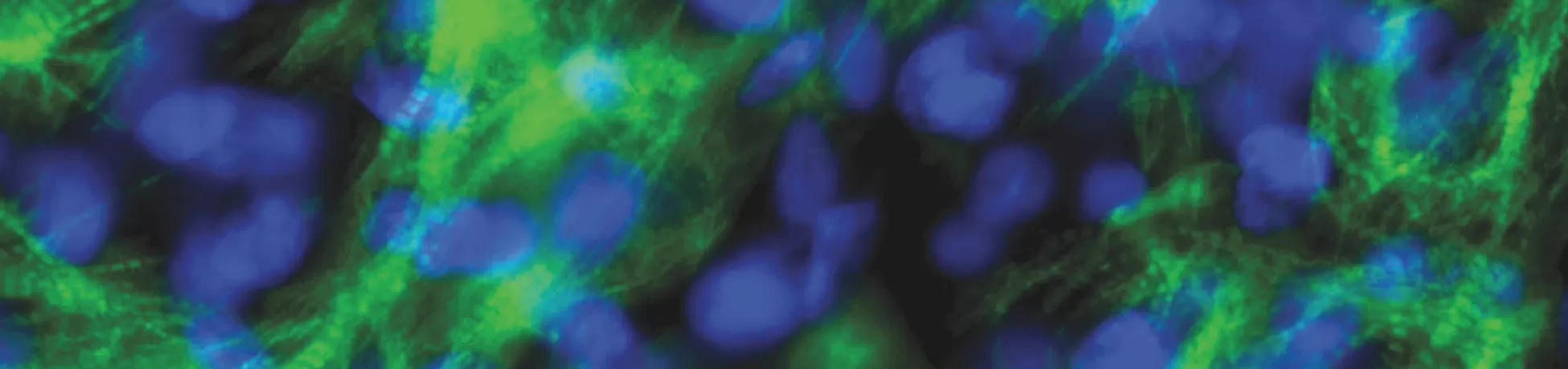 Electrically conditioned human cardiomyocytes. Striated ultrastructure containing troponin (stained in green) forms around cell nuclei (stained in blue)