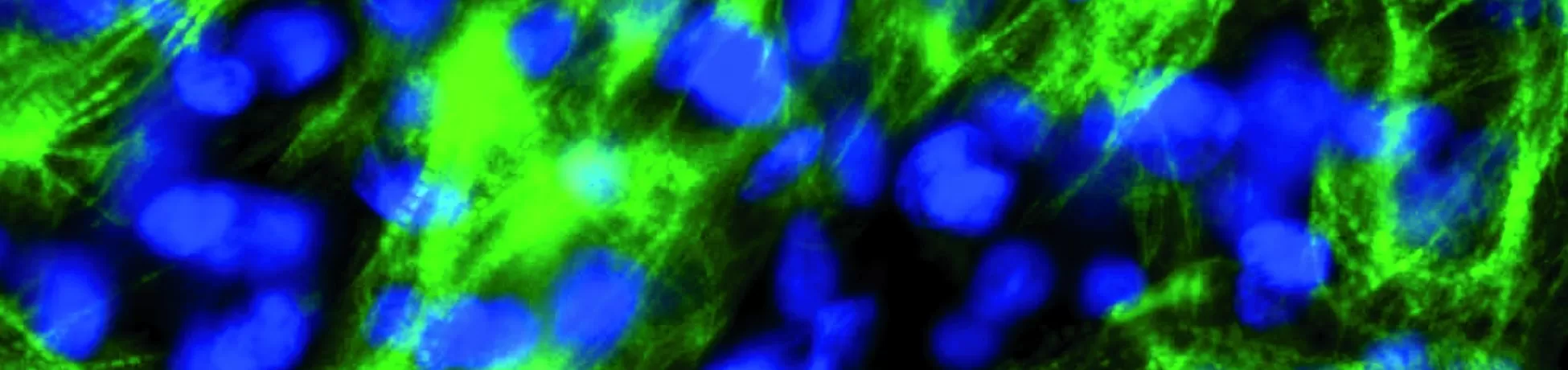 Fluorescent microscopy image showing bright green cellular fibers and blue nuclei against a dark background.