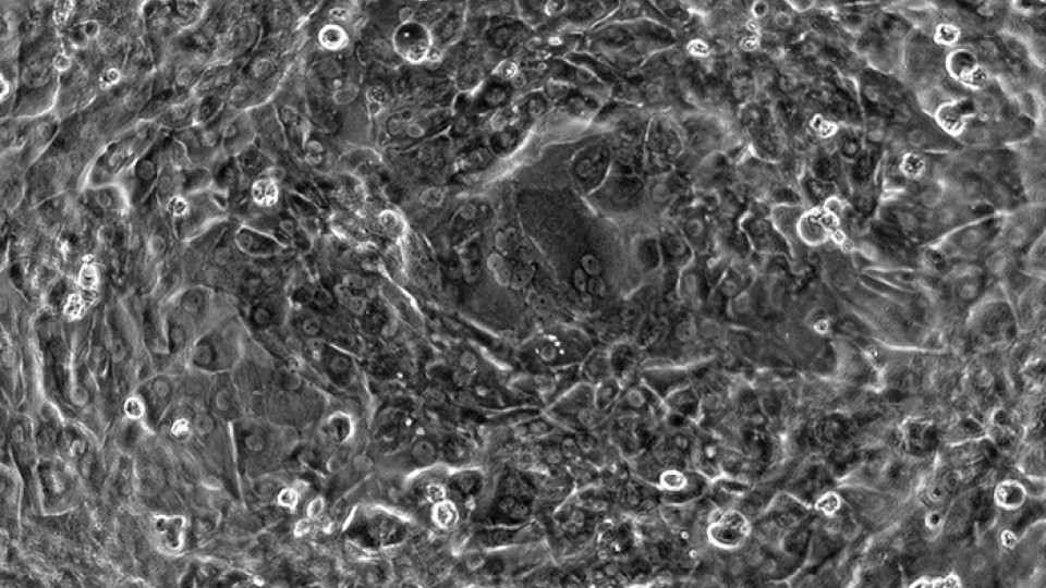Cardiac muscle cells under a miscroscope